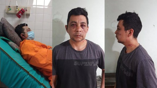 Murió el enfermero linchado hace un año por contagiarse covid: "Nunca se recuperó del rechazo social"