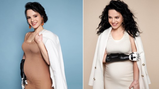 "Hoy me convertí en una madre-transformer": dio a luz la mujer a la que el marido le cortó las dos manos con un hacha