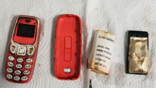 Tuvieron que operarlo de urgencia para sacarle del estómago un celular que se había tragado