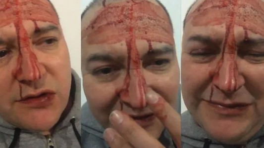 Leo García: la versión policial que duda del ataque homofóbico