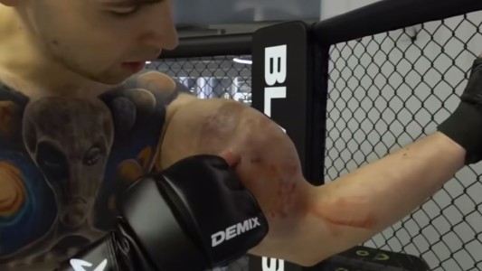 Video: así explotaron los brazos del "Popeye ruso" en pleno combate de artes marciales
