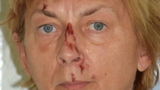 Misterio: apareció una mujer en una isla, sin documentos y no sabe nada de su vida