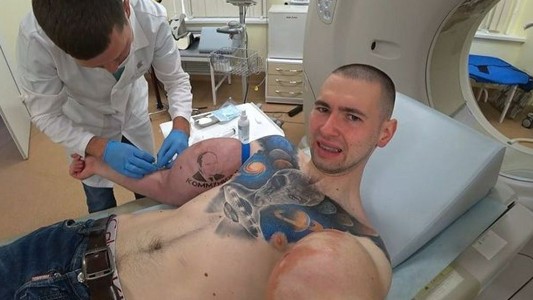 El Popeye ruso se someterá a una operación riesgosa tras reventar sus brazos en un combate de MMA