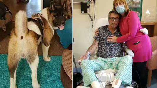 Compró un perro por Facebook que mordió a su hermano y a su marido: uno murió y al otro le amputarán las piernas