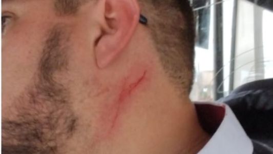 URGENTE: atacaron con un cuchillo a un chofer de la línea 73