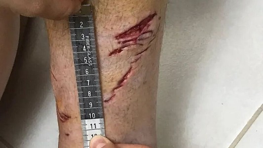 Un tiburón mordió a un turista en una playa del sureste de Brasil