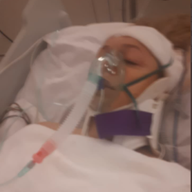 Brutal golpiza a una mujer por una bici: terminó internada en grave estado