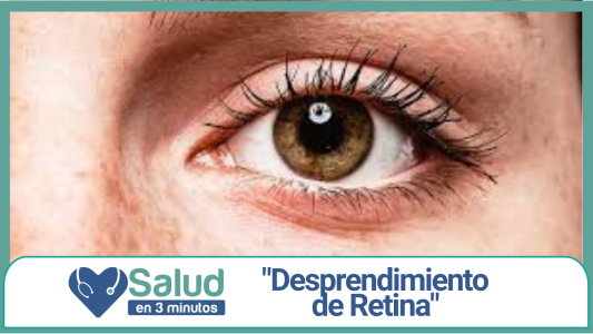 ¿Porqué debemos conocer los síntomas del desprendimiento de retina?