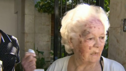"Me hice la muerta para que dejaran de pegarme": asaltaron a una mujer de 88 años