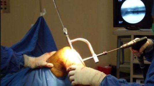 Condenaron a una cirujana tras amputarle a un paciente la pierna equivocada