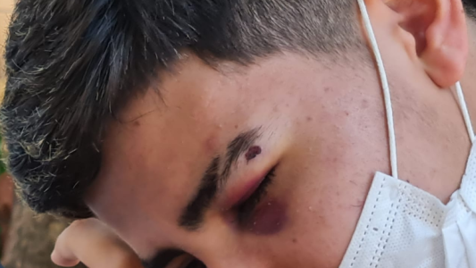 “Bebelo” Reynoso detenido: habló el adolescente agredido