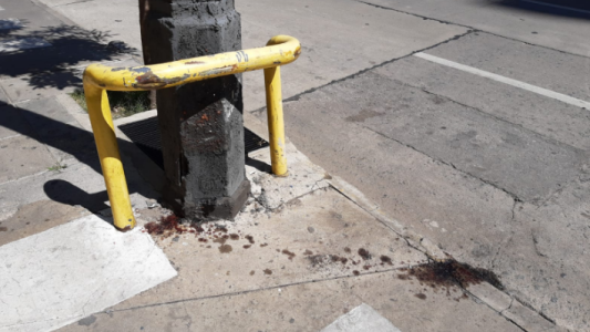 Grave accidente en el centro: adolescente perdió una pierna por el impacto de un auto