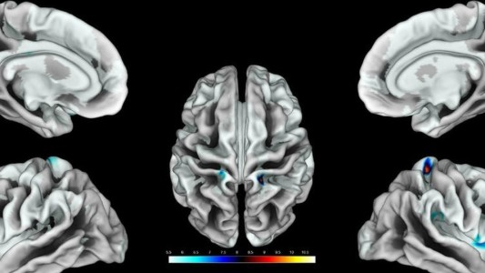 Fin del misterio: estudio científico identificó el área del cerebro que corresponde al clítoris