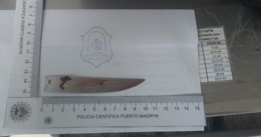 Milagro en Puerto Madryn: lo apuñalaron en el cráneo con un cuchillo de 10 centímetros y sobrevivió
