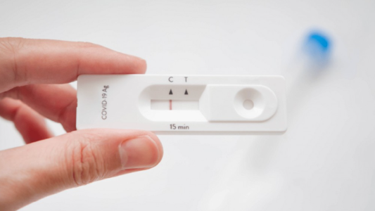 Autotest de Covid-19: estiman que la próxima semana todas las farmacias del país empezarán a venderlos