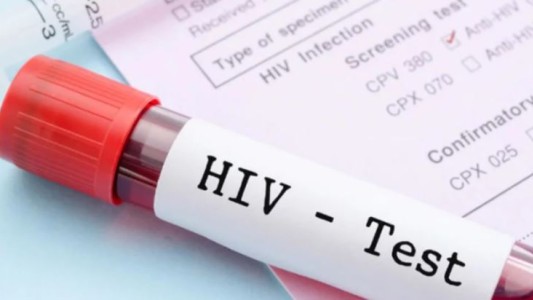 Identifican una variante del VIH más virulenta que circula desde hace décadas en Países Bajos