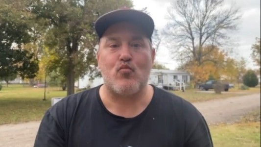 Desopilante: un mago consiguió sacar por su ojo un caramelo que había ingerido por la boca