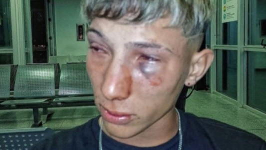 Violenta agresión en un boliche de Santa Fe: un grupo de patovicas le dio una brutal golpiza a un joven