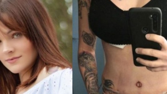 Fue a someterse a una reducción de mamas pero le colocaron implantes y le realizaron una liposucción