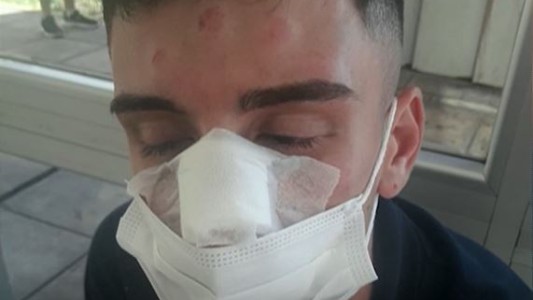 Video: Ataque salvaje de jugadores de rugby a la salida de un boliche en Aldo Bonzi