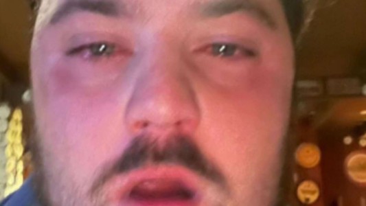 No estaba de acuerdo con los precio: atacó con gas pimienta al empleado de una cervecería y se fue sin pagar