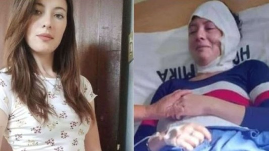 Una mujer fue a buscar la cuota alimentaria de su hijo y su ex marido le tiró aceite hirviendo en la cara