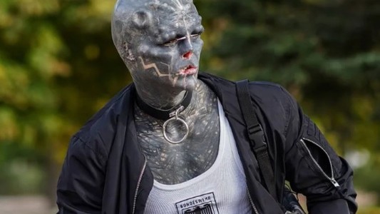 El hombre que quiere parecer un alien dice que ahora se amputará una pierna