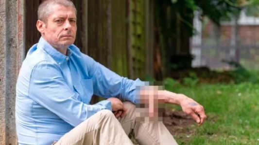 Vivió 6 años con un injerto de pene en el brazo y ahora se lo ubicaron en el lugar correcto