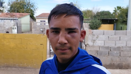 Batalla campal entre menores en la Liga de Punilla