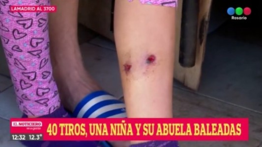 Feroz ataque sicario: una nena de 9 años recibió un tiro en la pierna