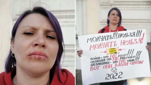 "No se puede estar callado": se cosió la boca en protesta por la invasión rusa a Ucrania