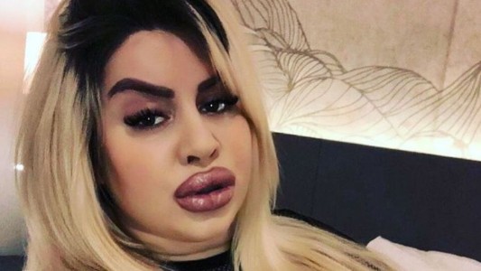 Se hizo 5 cirugías, gastó 150.000 dólares para tener la cola más grande del mundo y es una estrella en OnlyFans