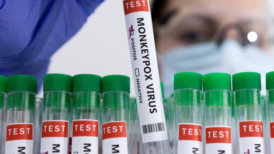 Estados Unidos distribuye la vacuna contra la viruela del mono