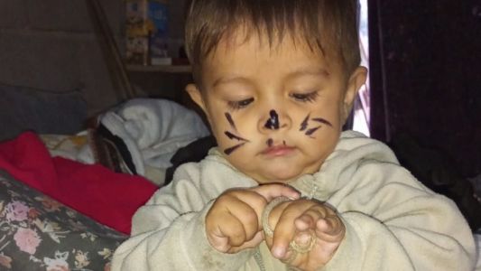 El pequeño nene catamarqueño se recupera y le darían el alta en las próximas horas