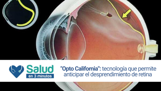 Sistema Opto California: Nuevo sistema de detección de enfermedades en la retina