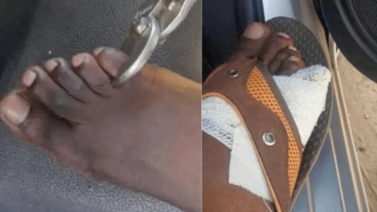 Aseguran que venden los dedos del pie por hasta US$ 40.000