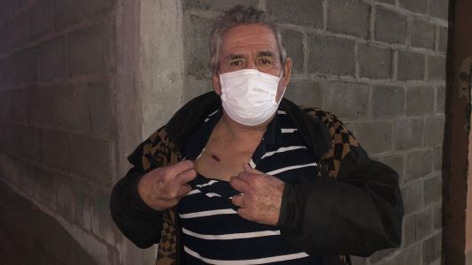Fue baleado en un asalto y lo salvo el marcapasos