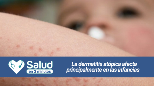 Hablamos de Dermatitis Atópica