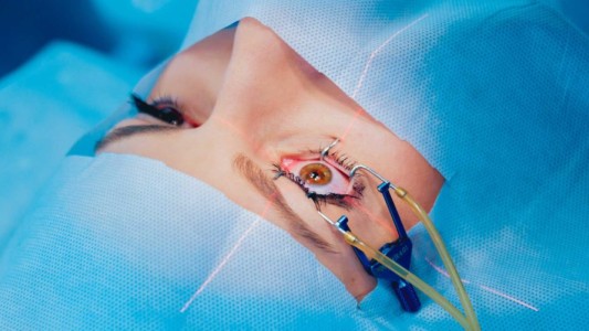 Le extrajo por error el ojo bueno a un paciente y lo dejó ciego