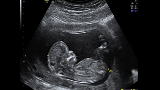 Asaltaron a una policía embarazada y se llevaron hasta la ecografía