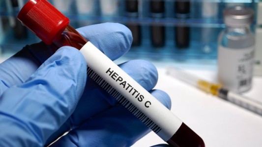 Solo 18% de personas diagnosticadas con hepatitis B y C realizan tratamiento
