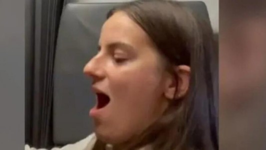 Video: dramático momento en un avión con un pasajera que bostezó y se le salió de lugar la mandíbula