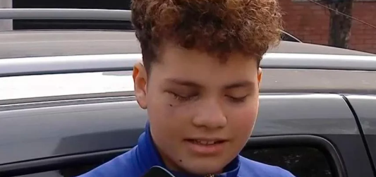 Le dieron el alta a Joaquín, el niño baleado en la cara durante un intento de robo: "Tengo miedo de salir a la calle"