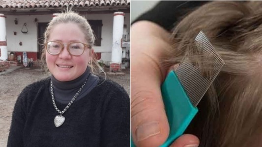 Trabaja medio día y para completar sus ingresos se ofrece como "sacadora de piojos"