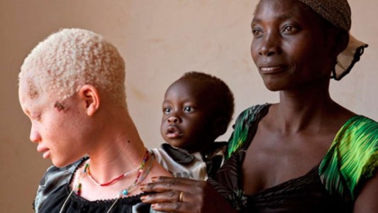 Al menos 18 muertos en Madagascar en protesta por el supuesto secuestro de un niño albino