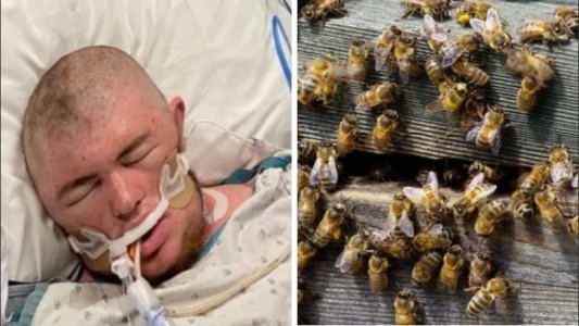 Sobrevivió de milagro tras ser picado 20 mil veces por abejas asesinas africanas