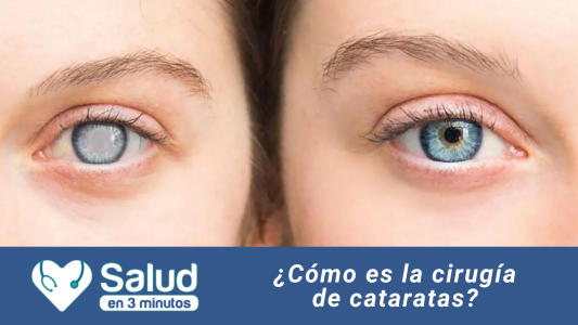 Cataratas, esta enfermedad forma parte de las llamadas cegueras reversibles,