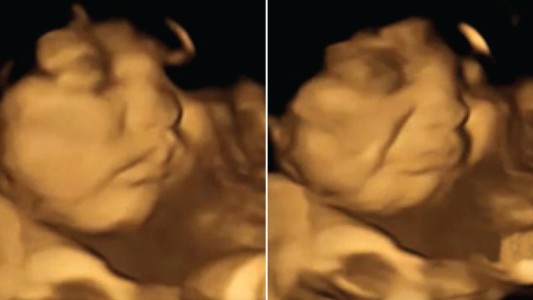 Muestran la reacción de los bebés al sentir olores y sabores en el útero