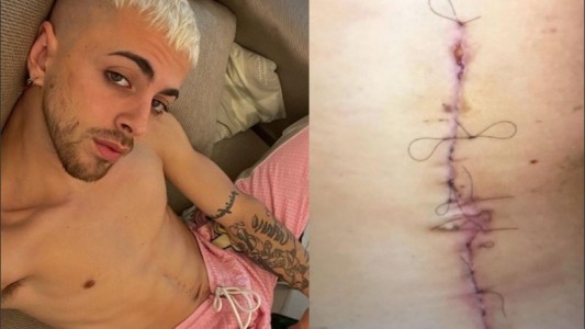 La llamativa cicatriz de J Rei en el abdomen