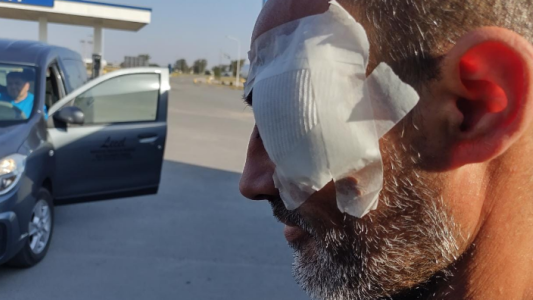 Policía denunciado por el “Negro” Videla fue imputado por lesiones